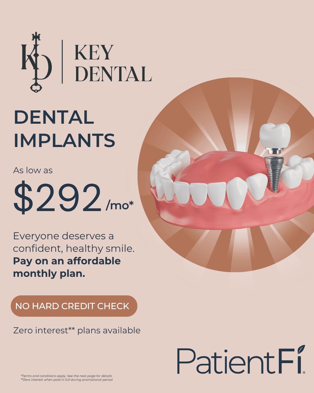Social media post promoting friendly monthly payment plans